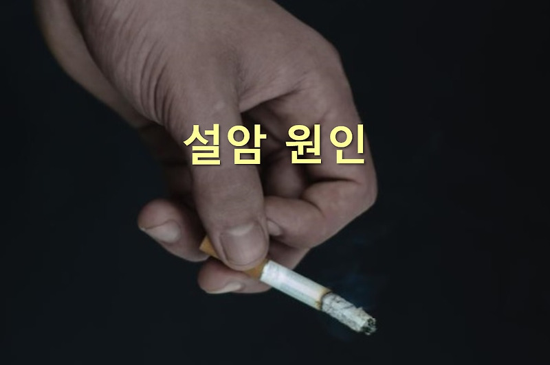 설암 초기증상과 설암 원인