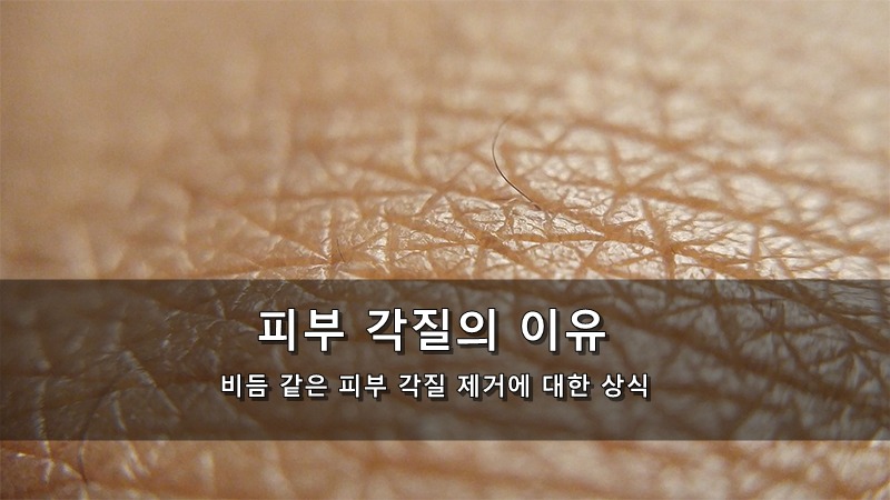 피부 각질이 생기는 이유 - 비듬 같은 피부 각질 제거에 대한 상식