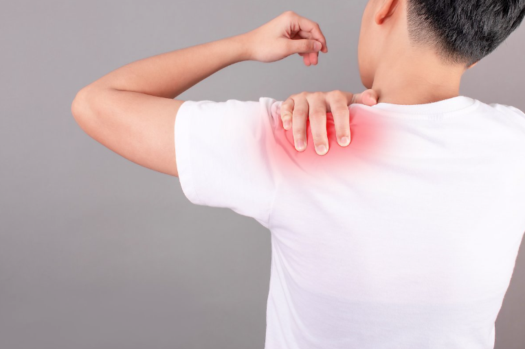 어깨 충돌증후군 원인, 증상 및 치료방법