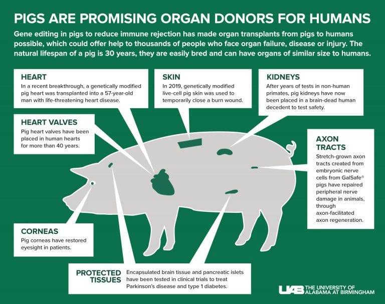 인간에게  사상 최초 돼지 신장 이종 이식 성공  VIDEO Pig-to-human kidney transplant 3D animation