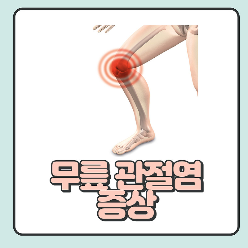 무릎 관절염 증상, 원인 및 치료법 자세하게 알아보기