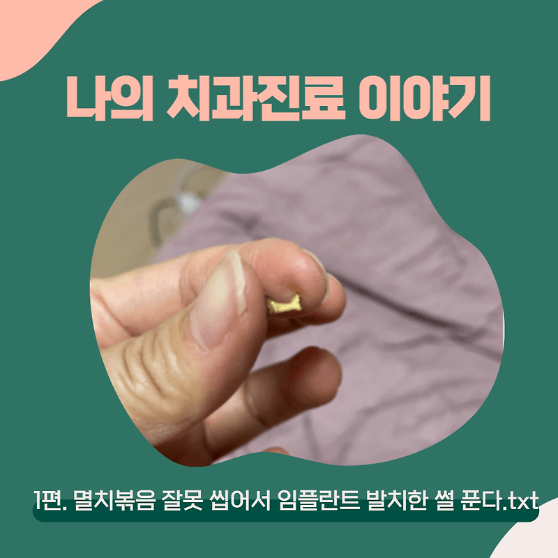 나의 치과 이야기(부제: 임플란트부터 재신경치료까지) - (1) 멸치볶음 잘못 먹어서 발치한 썰 푼다.