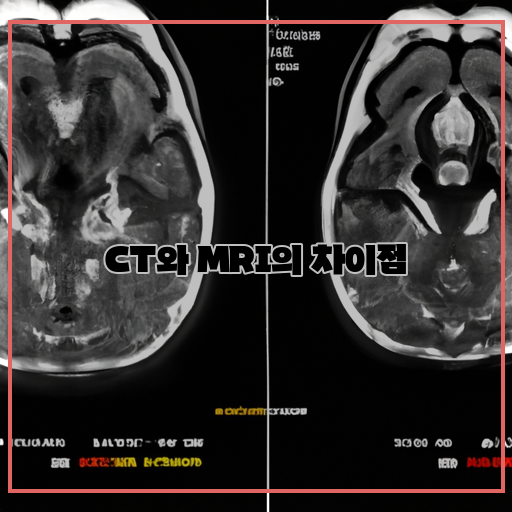 CT와 MRI의 비교: 뇌 이미징에서 어떤 차이가 있는가?