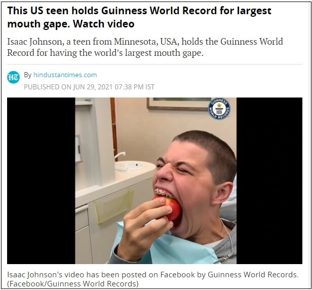 [기네스기록] 입 10cm 한번 벌려보세요...가능? VIDEO:This US teen holds Guinness World Record for largest mouth gape. Watch video
