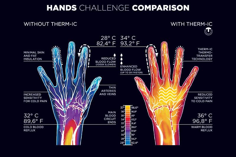 겨울이 코 앞에...환절기 체온 올리는 법 What is thermoregulation?