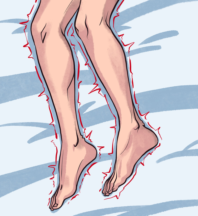 하지 불안 증후군 (restless legs syndrome)