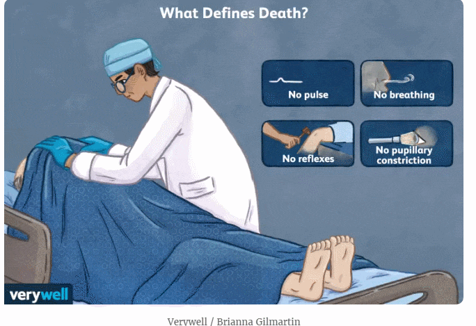 '생물학적 죽음'에 따른 몸의 변화 Here's What A Doctor Says Actually Happens When You Die