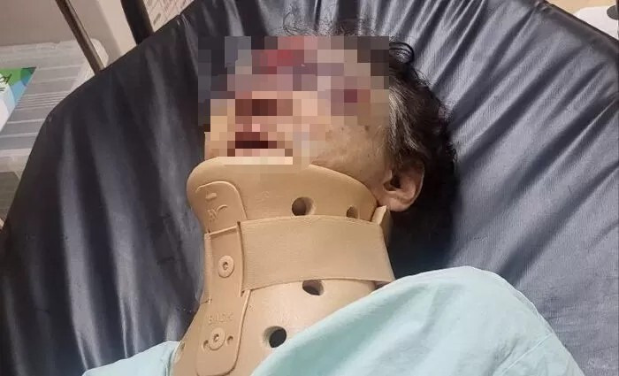 치매 실종된 할머니가 폭행당해 양주시 유양삼거리 목격자 찾습니다
