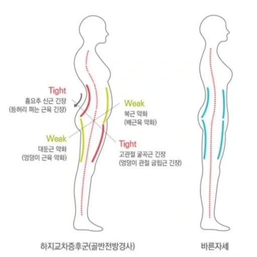 코어근육이 무너진 사람 특징