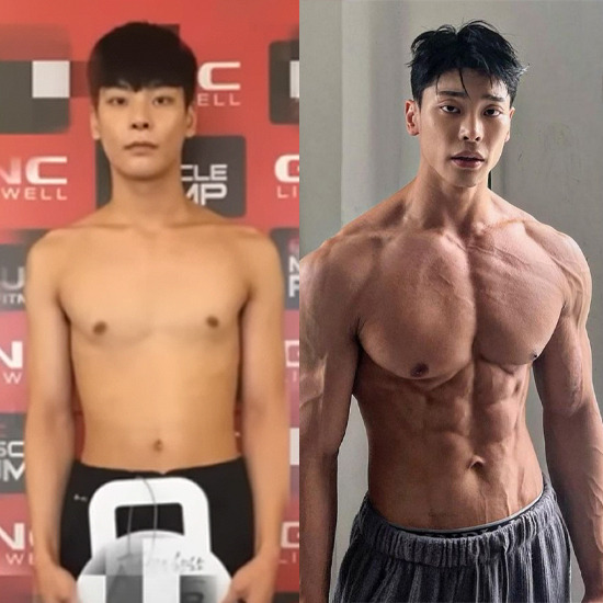 렛미인 김봉준 성형수술 근황, 월 수입 150배 (+인스타)