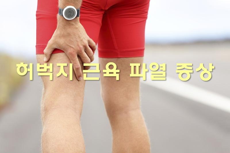 허벅지 근육 파열 증상과 허벅지 근육통 푸는법