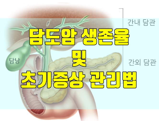 담도암 생존율 및 초기증상 관리방법