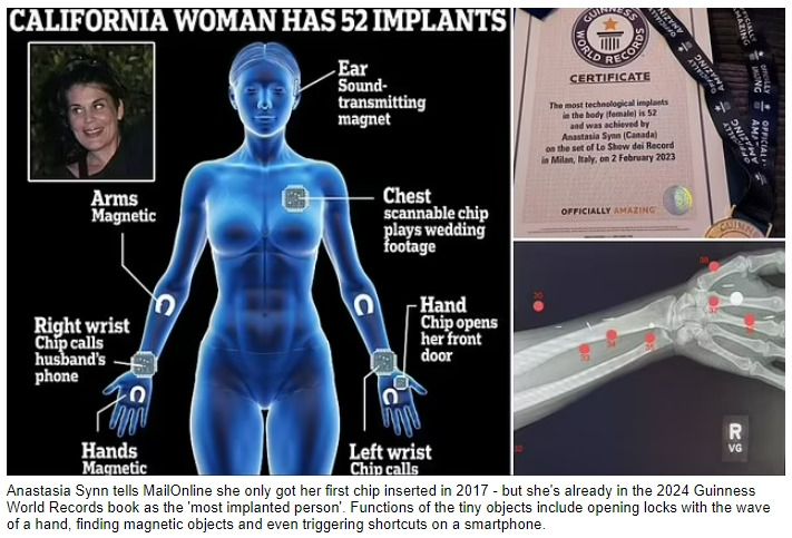 '세계 최고의 싸이보그 여성'...임플란트 기네스 세계 기록 VIDEO: Meet the California woman dubbed the 'world's ultimate CYBORG'