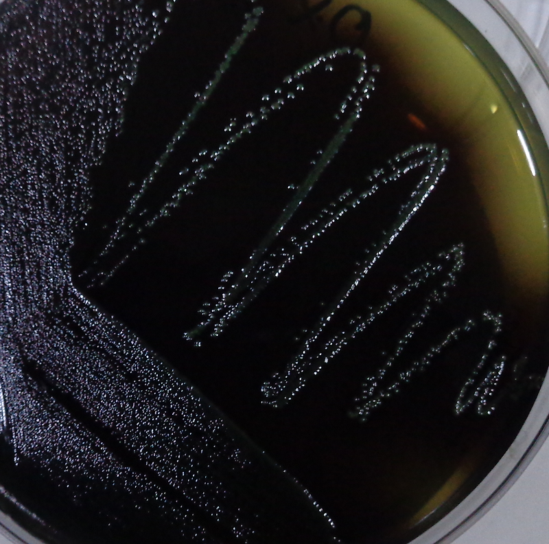 [식품공전] 리스테리아 모노사이토제네스 미생물시험법(Listeria monocytogenes)