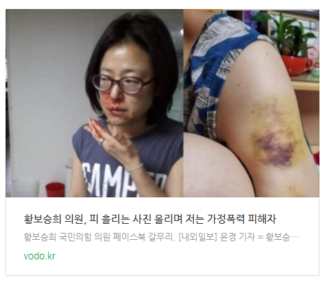 황보승희 의원, 피 흘리는 사진 올리며 