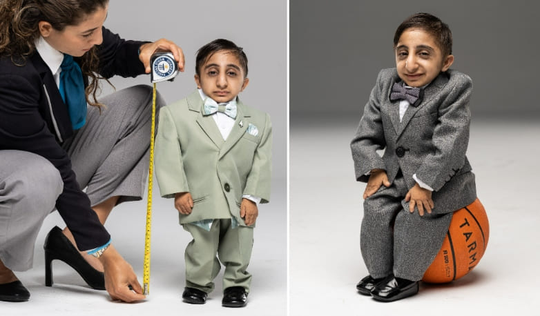 세계에서 가장 작은 남자...6.5kg? VIDEO: 20-year-old Iranian confirmed as world’s shortest man