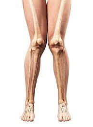 X자 다리 : 엑스자 다리 원인, 관절염 X자 다리, X자 다리 뼈 문제