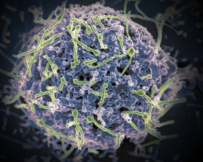 에볼라바이러스 감염 경로 및 증상, 예방법: 알아두면 좋아요!