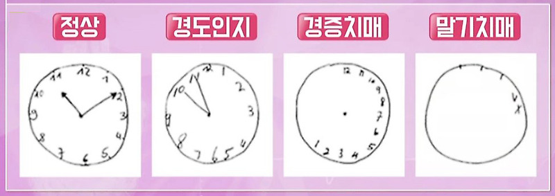 치매 확인, 시계 그리기 검사(Clock Drawing Test)