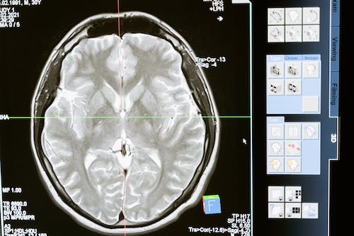 바이오 혁명의 불로장생: 뇌 건강을 위한 노년기 뇌 활성화의 뇌 연령 역전 전략