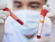 피검사로 알수있는것 혈액검사 비용 항목