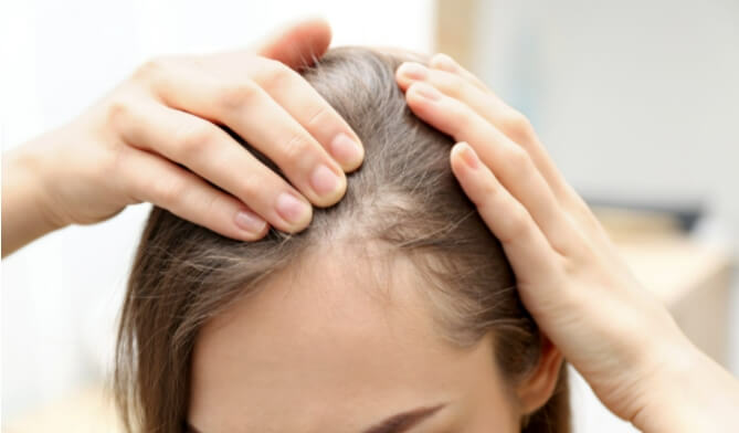 탈모 방지에 꼭 섭취해야 할 식품과 영양소 What to eat to prevent hair loss ?