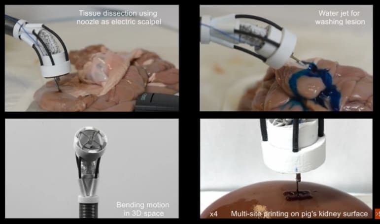 생체 재료로 조직 만드는  3D 프린팅 기술 VIDEO:The prototype could double as an all-in-one surgical tool