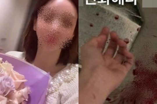 '남양 외손녀' 황하나, 4억 외제차 도난→피투성이 자해 