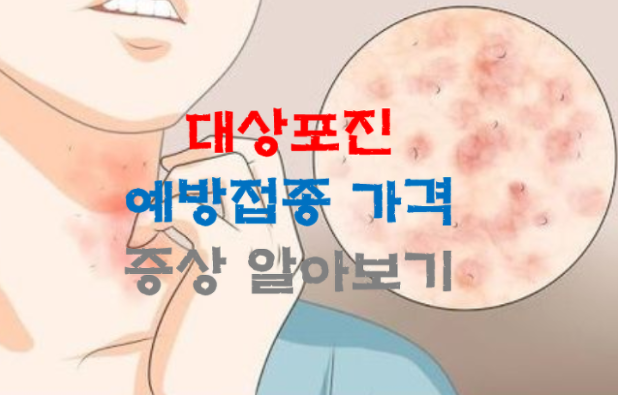 대상포진 예방접종 가격 비용 병원 총정리