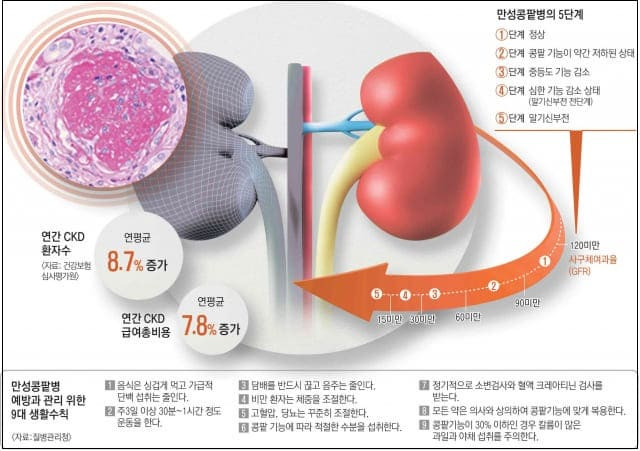 건강하던 콩팥이 갑자기 나빠질 때...