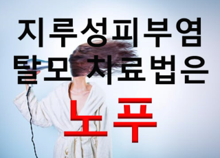 지루성두피염 탈모 치료방법은 