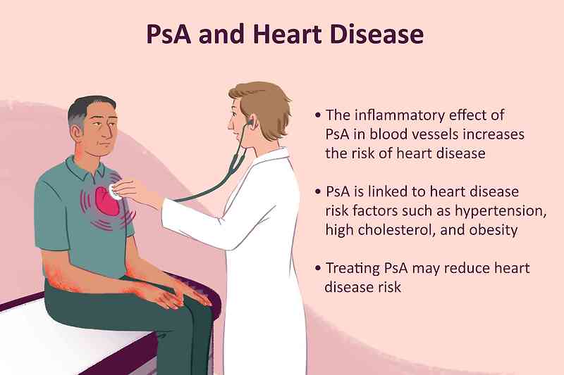 '건선' 심한 경우, 심장병 걸릴 위험 높다 People with severe psoriasis are at higher risk of heart disease, researchers say