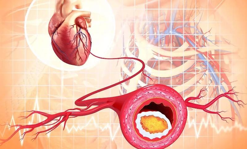 뱃살 없는데, 배 나와 보이는 경우 ㅣ 65세 이후의 신체 기능 저하   심혈관 질환 관련성 높아 Low physical function after age 65 associated with future cardiovascular disease