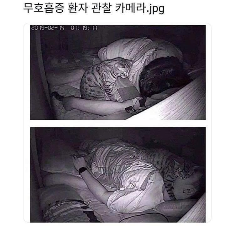 무호흡증 환자 관찰 카메라