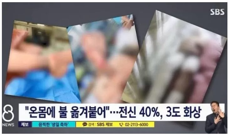 현실판 더글로리 '20대 청년 생일날 몸에 불 질러 인생 망치게 한 청년들'