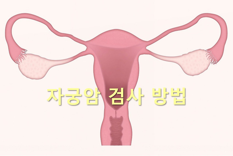 자궁경부암과 자궁체부암을 진단하는 자궁암 검사 방법