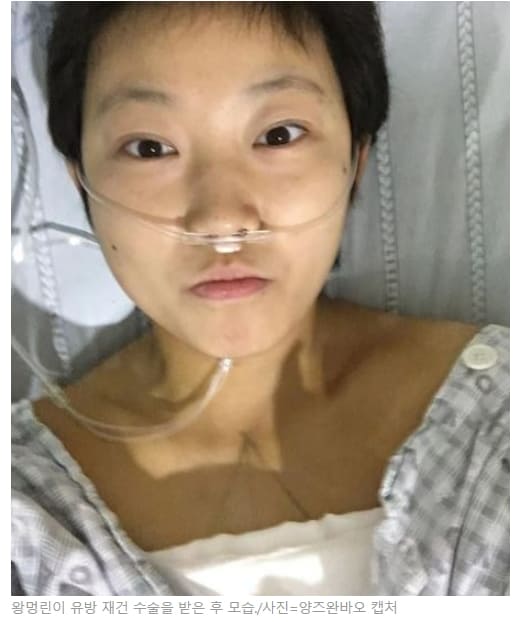 14살 이후로 18년간 다섯 가지 암 걸린 중국 여성...왜
