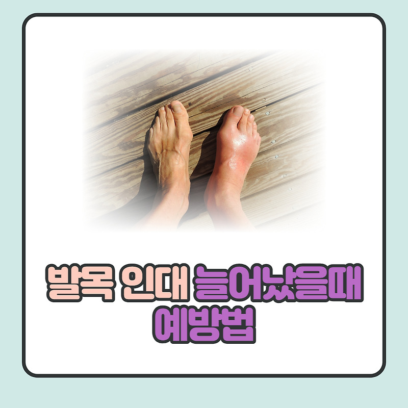 발목 인대 늘어났을때 치료방법 및 예방법 알아보기.