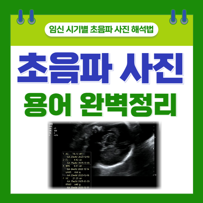 임신 시기별 초음파 사진 해석법; 초기/중기 초음파 용어(영어) 완벽정리