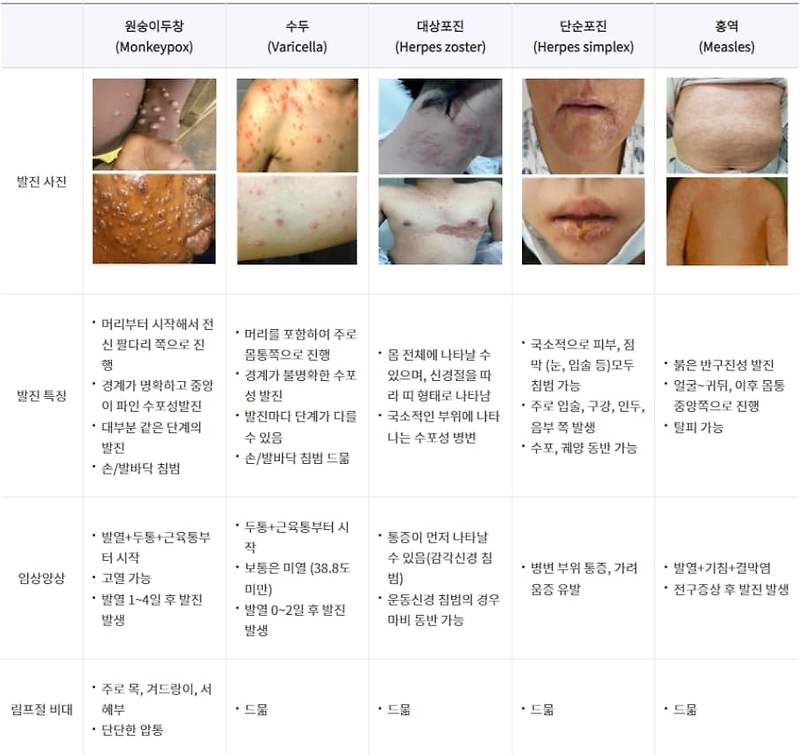 엠폭스(원숭이두창) 증상, 감염경로, 치사율