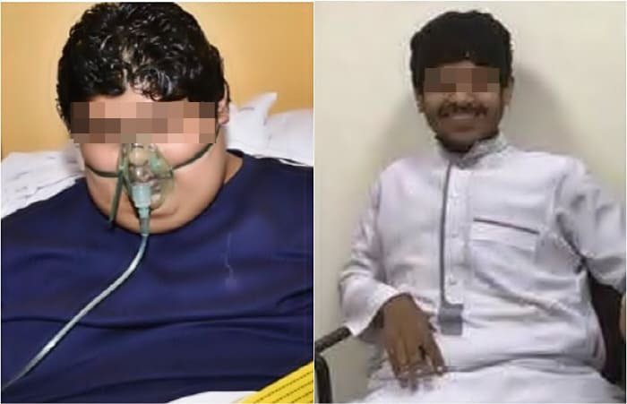 [토픽] 609kg에서 63kg로 감량이 가능한가 VIDEO: World's heaviest teen, Khaled Mohsen Al Shaeri, reveals dramatic weight loss