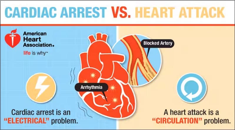 심장마비와 심정지의 차이 What's the difference between a heart attack and cardiac arrest?