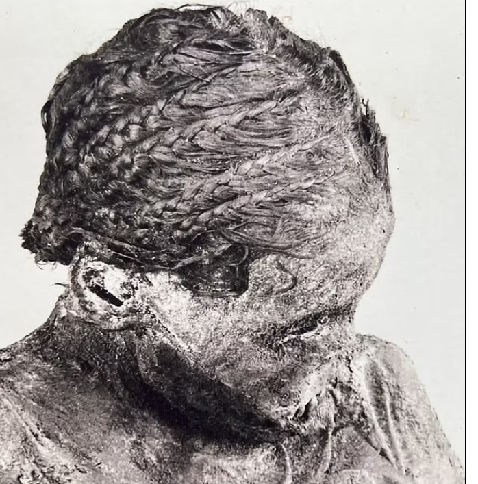  1천500여 년 전 쌍둥이 출산 중 사망한 10대 엄마 Archaeologists find baby's head in pelvis of ancient Egyptian teen mom who died in childbirth more than 1,500 years ago