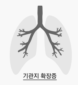 기관지 확장증(Bronchiectasis) 간호