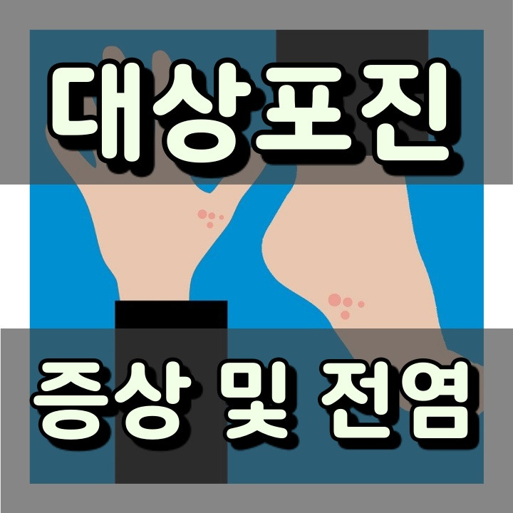 대상포진 증상 및 전염 가능성 (아기는 조심해야 하는 이유)