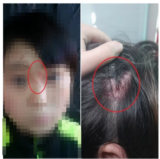 전남 목포 태권도 관장 '품새 못한다' 11세 아동 폭행 머리뼈 골절 전치 8주