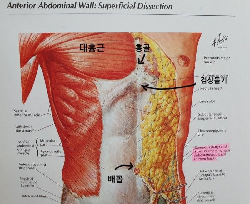 갈비뼈 중앙에 혹이 잡히는 경우