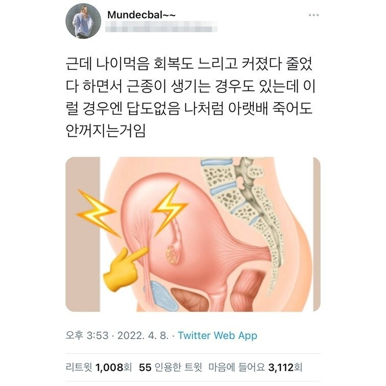 생리기간 아랫배툭튀