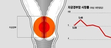 자궁경부암 증상, 자궁경부암 예방접종 가격 및 시기