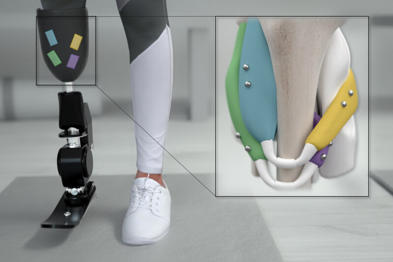 MIT 미디어 랩, 더 정밀하게 제어할 수 있는 의족 기술 개발 VIDEO:Magnets could offer better control of prosthetic limbs
